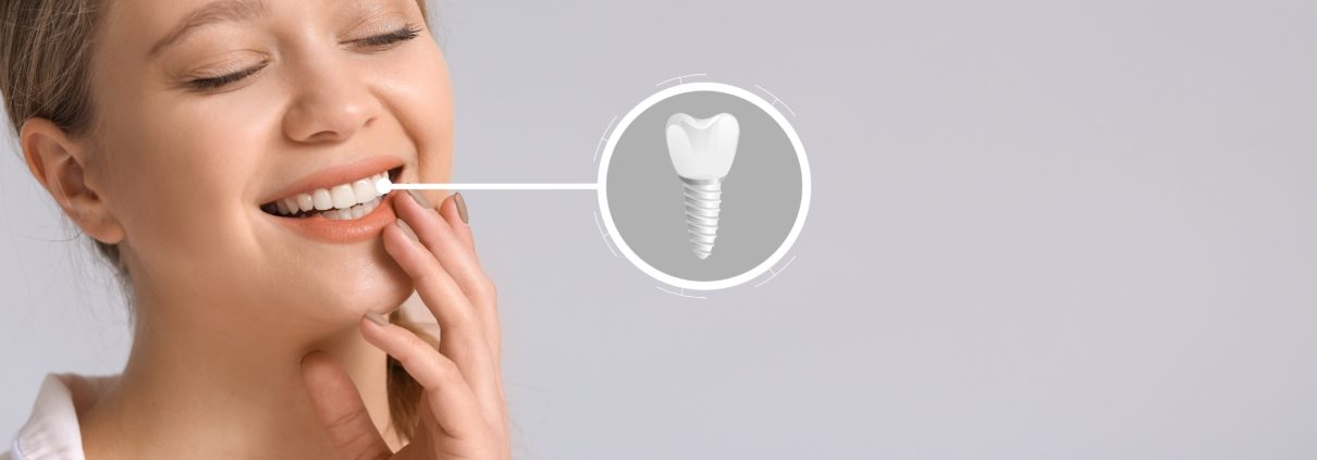 Implant dentaire titane ou zircone
