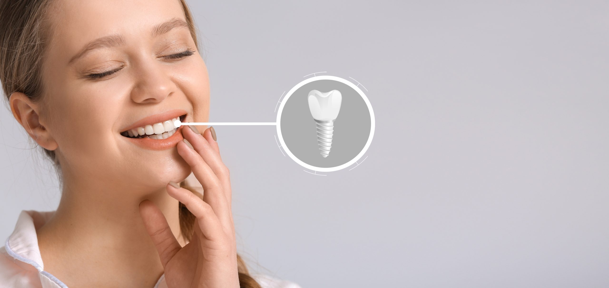 Implant dentaire titane ou zircone