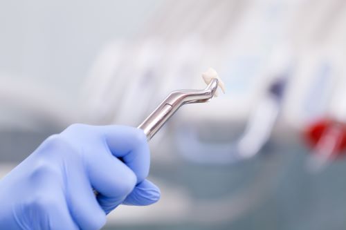 Causes du recours à l’extraction dentaire